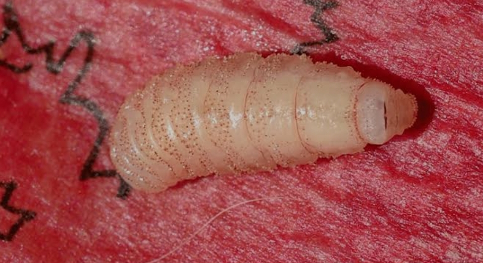 Botfly Removal